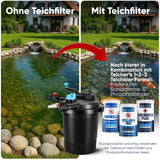 Komplettset (Filter/Pumpe/Schlauch) / 10.000 l/h